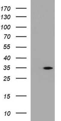 Western Blot: ANKRD49 Antibody (OTI3E4) - Azide and BSA Free [NBP2-71971] - Analysis of HEK293T cells were transfected with the pCMV6-ENTRY control (Left lane) or pCMV6-ENTRY ANKRD49.