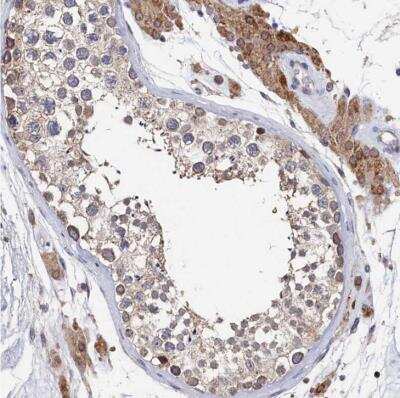 Immunohistochemistry-Paraffin: ANKRD5 Antibody [NBP1-85163] - Staining of human testis shows moderate cytoplasmic positivity in subset of cells in seminiferous ducts and in Leydig cells.