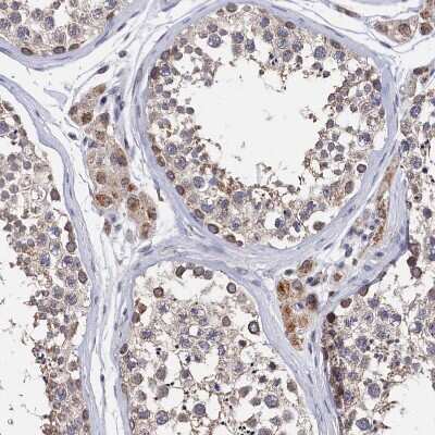 Immunohistochemistry-Paraffin: ANKRD5 Antibody [NBP1-85163] - Staining of human testis shows moderate cytoplasmic and nuclear positivity in cells in seminiferous ducts.