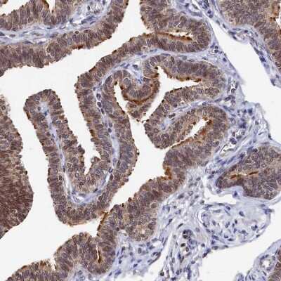 Immunohistochemistry-Paraffin: ANKRD5 Antibody [NBP1-85163] - Staining of human fallopian tube shows strong positivity in cilia in glandular cells.