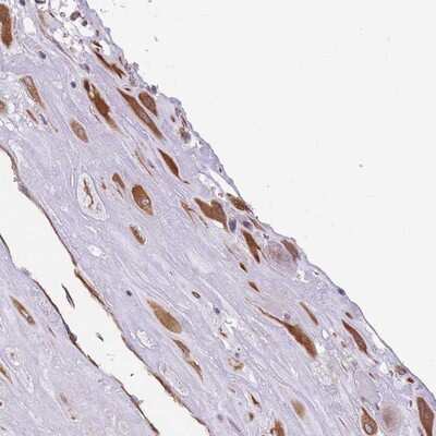 Immunohistochemistry-Paraffin: ANKRD53 Antibody [NBP2-14294] - Staining of human placenta shows strong cytoplasmic positivity in decidua cells.