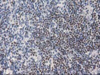 Immunohistochemistry: ANKRD53 Antibody (OTI1E1) - Azide and BSA Free [NBP2-72217] - Staining of paraffin-embedded Human lymphoma tissue using anti-ANKRD53 mouse monoclonal antibody.
