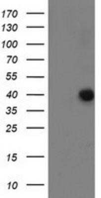 Western Blot: ANKRD53 Antibody (OTI1E1) - Azide and BSA Free [NBP2-72217] - HEK293T cells were transfected with the pCMV6-ENTRY control (Left lane) or pCMV6-ENTRY ANKRD53 (Right lane) cDNA for 48 hrs and lysed. Equivalent amounts of cell lysates (5 ug per lane) were separated by SDS-PAGE and immunoblotted with anti-ANKRD53.