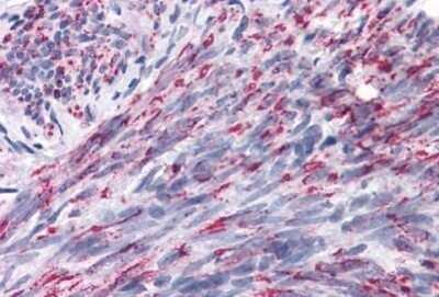 Immunohistochemistry-Paraffin: ANKRD54 Antibody [NBP1-71987] - Staining of human uterus. Immunohistochemistry of formalin-fixed, paraffin-embedded tissue after heat-induced antigen retrieval. Antibody concentration 5 ug/ml.