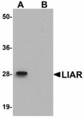 Western Blot: ANKRD54 Antibody [NBP1-71987] - Western blot of ANKRD54 in mouse kidney tissue lysate with ANKRD54 antibody at 1 ug/ml in (A) the absence and (B) the presence of blocking peptide.