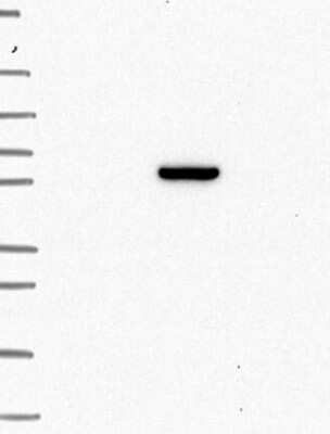 Western Blot: ANKRD55 Antibody [NBP3-17467] - Lane 1: Marker [kDa] 250, 130, 95, 72, 55, 36, 28, 17, 10;   Lane 2: RT4;   Lane 3: U-251 MG;   Lane 4: Human Plasma;   Lane 5: Liver;   Lane 6: Tonsil