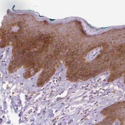 Immunohistochemistry-Paraffin: ANKRD57 Antibody [NBP2-49215] - Staining of human skin shows cytoplasmic positivity in epidermal cells.