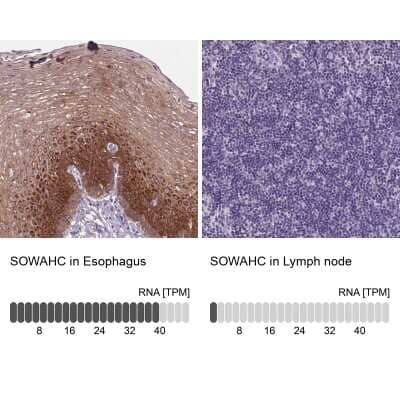 Immunohistochemistry-Paraffin: ANKRD57 Antibody [NBP2-49215] - Staining in human esophagus and lymph node tissues using anti-SOWAHC antibody. Corresponding SOWAHC RNA-seq data are presented for the same tissues.