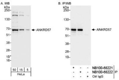 Western Blot: ANKRD57 Antibody [NB100-68221] - Detection of Human ANKRD57 on HeLa whole cell lysate using NB100-68221. ANKRD57 was also  immunoprecipitated by rabbit anti-ANKRD57 antibody NB100-68222.