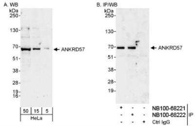 Western Blot: ANKRD57 Antibody [NB100-68222] - Detection of Human ANKRD57 on HeLa whole cell lysate using NB100-68222. ANKRD57 was also  immunoprecipitated by rabbit anti-ANKRD57 antibody NB100-68221.