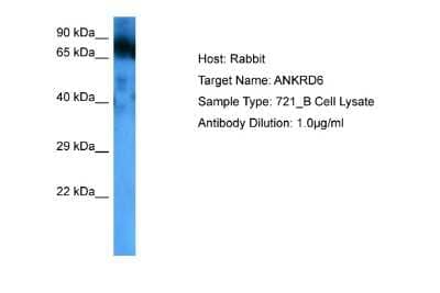 Western Blot: ANKRD6 Antibody [NBP2-87008] - Host: Rabbit. Target Name: ANKRD6. Sample Tissue: Human 721_B lymphoblast Whole Cell. Antibody Dilution: 1.0ug/ml