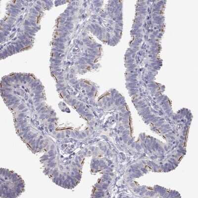 Immunohistochemistry-Paraffin: ANKRD65 Antibody [NBP2-39062] - Staining of human fallopian tube shows high expression.