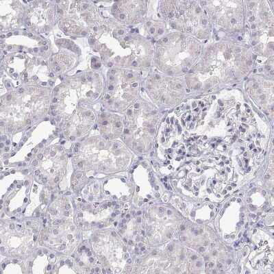 Immunohistochemistry-Paraffin: ANKRD65 Antibody [NBP2-39062] - Staining of human kidney shows low expression as expected.