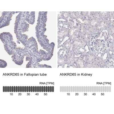 Immunohistochemistry-Paraffin: ANKRD65 Antibody [NBP2-39062] - Staining in human fallopian tube and kidney tissues using anti-ANKRD65 antibody. Corresponding ANKRD65 RNA-seq data are presented for the same tissues.