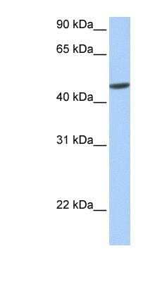 Western Blot: ANKRD65 Antibody [NBP1-91320] - Human Muscle lysate, concentration 0.2-1 ug/ml.