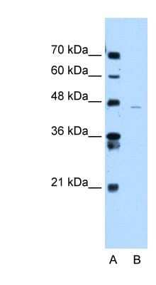 Western Blot ANKRD65 Antibody - BSA Free