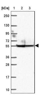 Western Blot: ANKRD65 Antibody [NBP2-39062] - Lane 1: Marker  [kDa] 250, 130, 95, 72, 55, 36, 28, 17, 10.  Lane 2: Human cell line RT-4.  Lane 3: Human cell line U-251MG