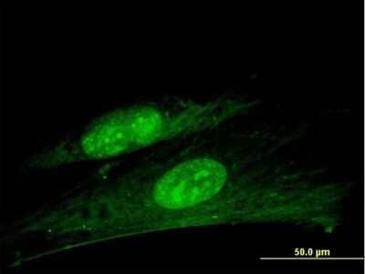 Immunocytochemistry/ Immunofluorescence ANKRD7 Antibody - Azide and BSA Free