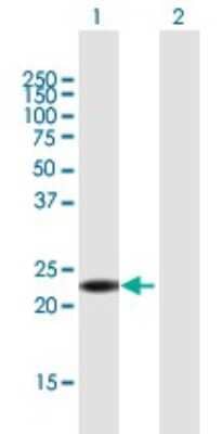 Western Blot ANKRD7 Antibody - Azide and BSA Free