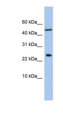 Western Blot: ANKRD7 Antibody [NBP1-57699] - 721_B cell lysate, concentration 0.2-1 ug/ml.