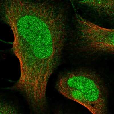 Immunocytochemistry/ Immunofluorescence ANKS1A Antibody