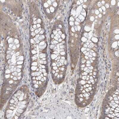 Immunohistochemistry-Paraffin ANKS1A Antibody