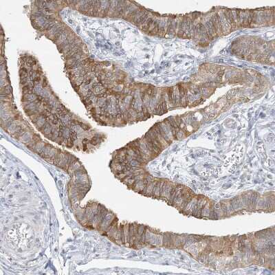 Immunohistochemistry-Paraffin ANKS1A Antibody