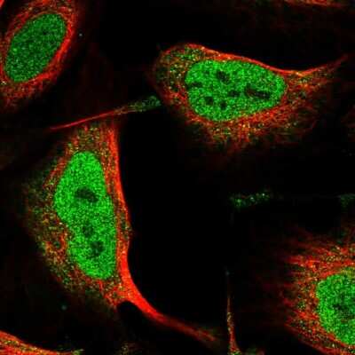 Immunocytochemistry/Immunofluorescence: ANKS3 Antibody [NBP1-83531] - Immunofluorescent staining of human cell line U-2 OS shows localization to nucleoplasm & cytosol.