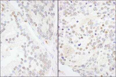 Immunohistochemistry-Paraffin ANKS3 Antibody