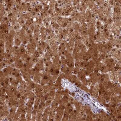 Immunohistochemistry-Paraffin: ANKS3 Antibody [NBP1-83531] - Staining of human liver shows strong cytoplasmic and nuclear positivity in hepatocytes.