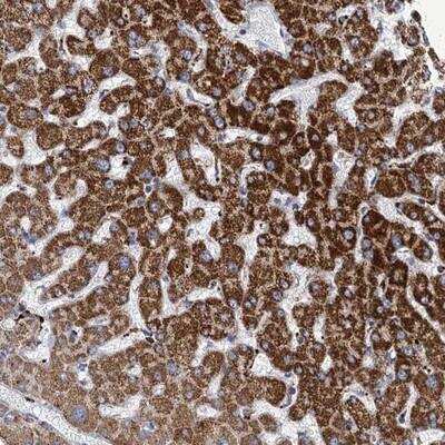 Immunohistochemistry-Paraffin: ANKS3 Antibody [NBP1-83532] - Staining of human liver shows strong cytoplasmic positivity in hepatocytes.