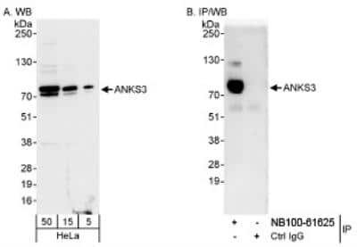 Western Blot ANKS3 Antibody