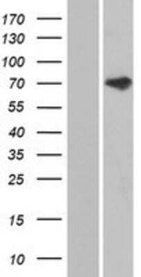 Western Blot: ANKS3 Overexpression Lysate (Adult Normal) [NBP2-05698] Left-Empty vector transfected control cell lysate (HEK293 cell lysate); Right -Over-expression Lysate for ANKS3.