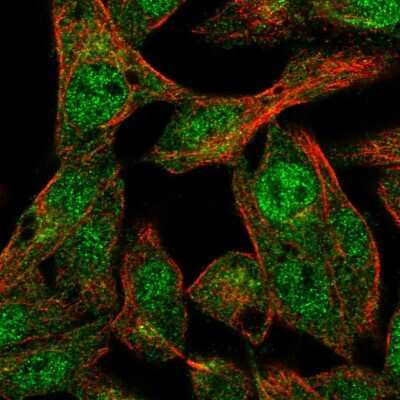 Immunocytochemistry/Immunofluorescence: ANKS4B Antibody [NBP1-91672] - Immunofluorescent staining of human cell line Hep G2 shows localization to nucleoplasm &amp; cytosol.