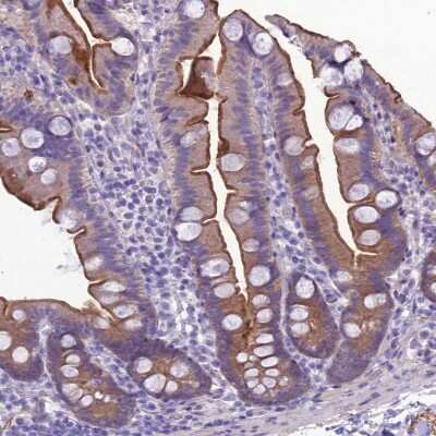 Immunohistochemistry-Paraffin: ANKS4B Antibody [NBP1-91672] - Staining of human small intestine shows moderate luminal membranous positivity in glandular cells.