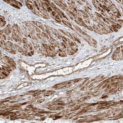 Immunohistochemistry-Paraffin ANKZF1 Antibody - BSA Free