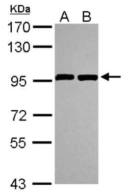 Western Blot: ANKZF1 Antibody [NBP2-15403] - Sample (30 ug of whole cell lysate) A: Hela B: Hep G2 7. 5% SDS PAGE; antibody diluted at 1:1000.