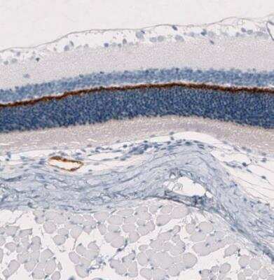 Immunohistochemistry-Paraffin: ANO2 Antibody (CL10631) [NBP3-07992] - Staining of rat eye retina shows strong positivity in the outer plexiform layer.