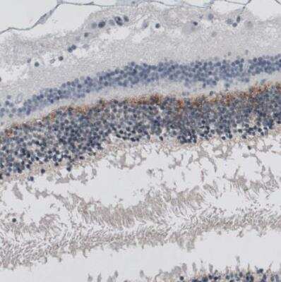 Immunohistochemistry-Paraffin: ANO2 Antibody (CL10631) [NBP3-07992] - Staining of human eye retina shows moderate positivity in the outer plexiform layer.