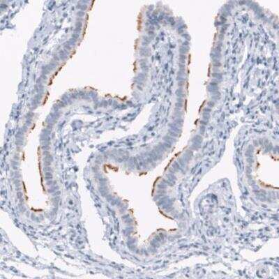 Immunohistochemistry-Paraffin: ANO2 Antibody (CL10631) [NBP3-07992] - Staining of human fallopian tube shows moderate positivity in cilia in glandular cells.