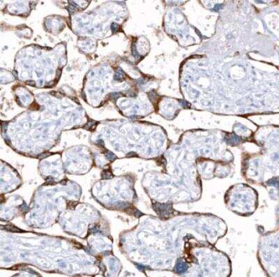 Immunohistochemistry-Paraffin: ANO2 Antibody (CL10631) [NBP3-07992] - Staining of human placenta shows strong cytoplasmic positivity in trophoblastic cells.