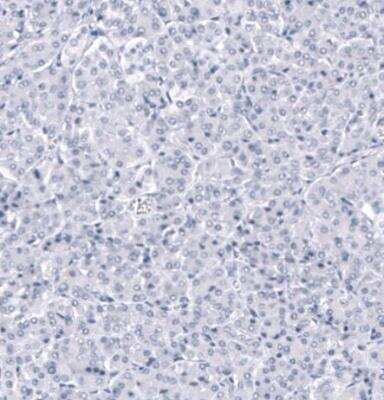 Immunohistochemistry-Paraffin ANO2 Antibody (CL10632)