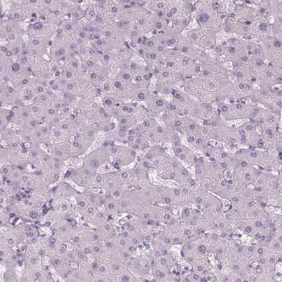 Immunohistochemistry-Paraffin: ANO2 Antibody [NBP2-68732] - Staining of human liver shows no positivity in hepatocytes as expected.