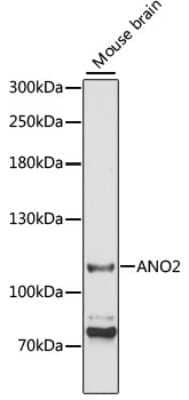 Western Blot: ANO2 Antibody - Azide and BSA Free [NBP2-92888] Analysis of extracts of mouse brain, using ANO2 at 1:3000 dilution.Secondary antibody: HRP Goat Anti-Rabbit IgG (H+L) at 1:10000 dilution.Lysates/proteins: 25ug per lane.Blocking buffer: 3% nonfat dry milk in TBST.Detection: ECL Basic Kit .Exposure time: