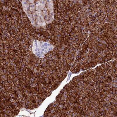 Immunohistochemistry-Paraffin ANO6 Antibody