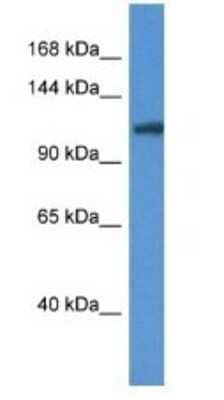 Western Blot: ANO6 Antibody [NBP1-74204] - Mouse Liver Lysate 1ug/ml Gel Concentration 6-18%