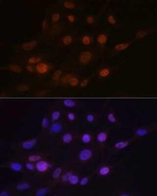 Immunocytochemistry/Immunofluorescence: ANP32B Antibody (4A8E5) [NBP3-16199] - Immunofluorescence analysis of C6 cells using ANP32B Rabbit mAb (NBP3-16199) at dilution of 1:100 (40x lens). Blue: DAPI for nuclear staining.