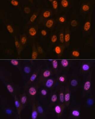 Immunocytochemistry/Immunofluorescence: ANP32B Antibody (4A8E5) [NBP3-16199] - Immunofluorescence analysis of NIH-3T3 cells using ANP32B Rabbit mAb (NBP3-16199) at dilution of 1:100 (40x lens). Blue: DAPI for nuclear staining.