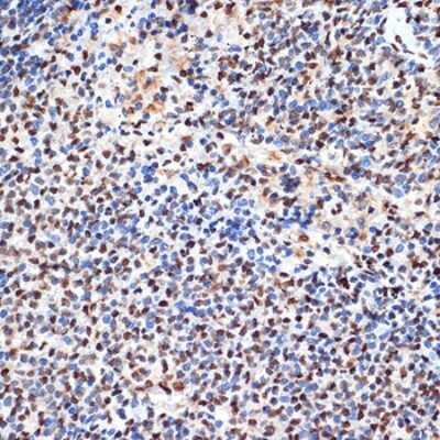 Immunohistochemistry-Paraffin: ANP32B Antibody (4A8E5) [NBP3-16199] - Immunohistochemistry of paraffin-embedded rat spleen using ANP32B Rabbit mAb (NBP3-16199) at dilution of 1:100 (40x lens).Perform microwave antigen retrieval with 10 mM Tris/EDTA buffer pH 9.0 before commencing with IHC staining protocol.