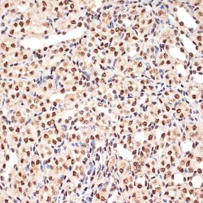 Immunohistochemistry-Paraffin: ANP32B Antibody (4A8E5) [NBP3-16199] - Immunohistochemistry of paraffin-embedded mouse kidney using ANP32B Rabbit mAb (NBP3-16199) at dilution of 1:100 (40x lens).Perform microwave antigen retrieval with 10 mM Tris/EDTA buffer pH 9.0 before commencing with IHC staining protocol.